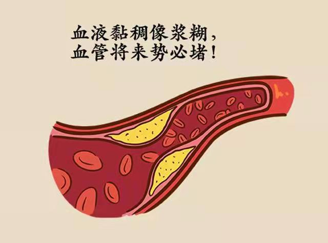 血稠怎么办？一张方子，降血脂、化血黏，送给中老年朋友（转发今日头条）